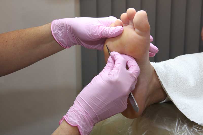 pedicure zoetermeer